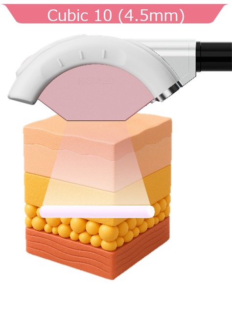 骨美容×REFTONE：深層アプローチ